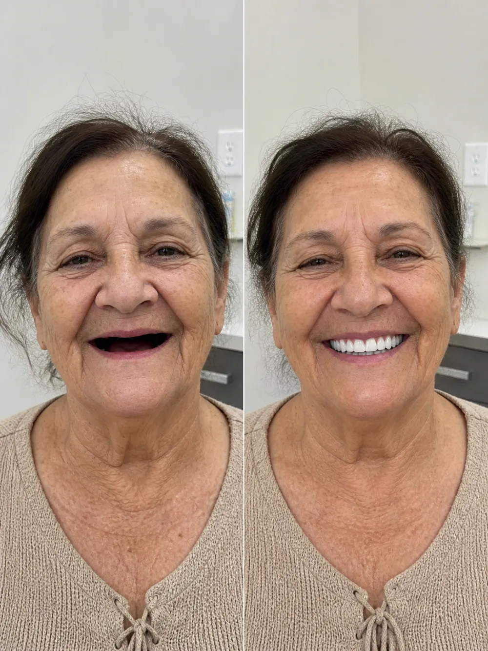 Transformação de paciente — sorriso planejado