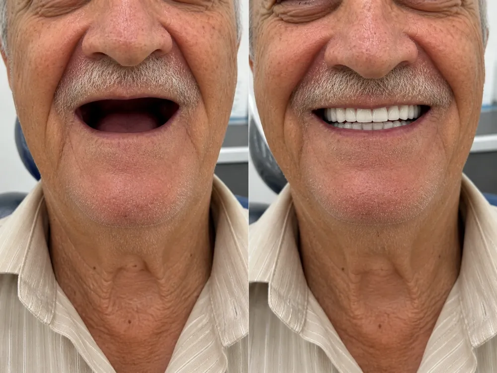 Transformação de paciente — sorriso planejado