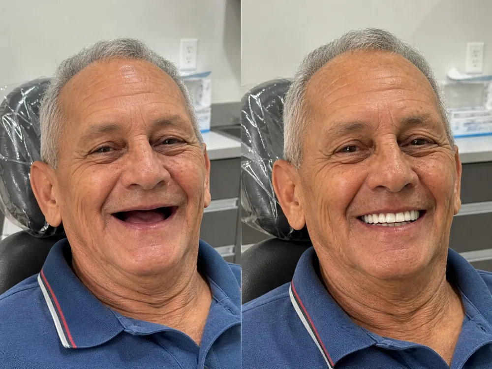 Transformação de paciente — sorriso planejado